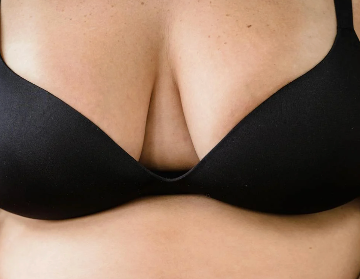 台北女王波隆乳張智皓醫師案例