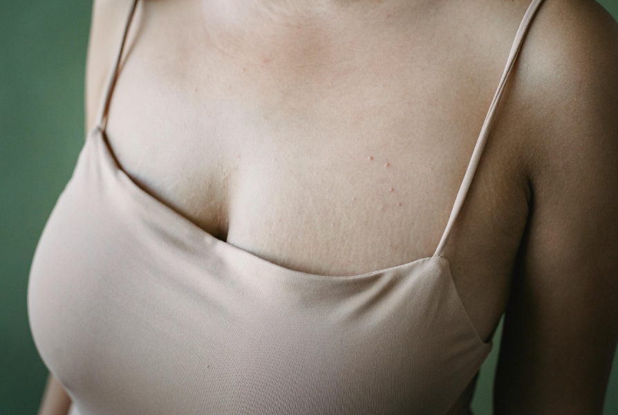 特寫鏡頭，一位女性胸部和鎖骨部位。她穿著一件米色或淺棕色細肩帶上衣，突顯了胸部上方的肌膚紋理和輕微的痘印。背景為深綠色