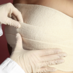 一名醫護人員戴著白色乳膠手套，正細心地為一名女性的胸部纏繞並調整彈性繃帶，呈現出整形手術後或醫療護理的術後加壓包紮過程。