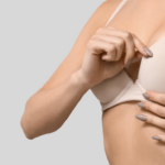 女性穿著淺色內衣，展示胸部線條與術前術後評估效果